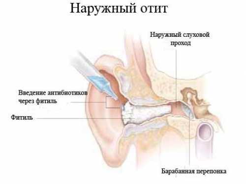 Вода ведь уменьшает боль, снимает спазмы мышц